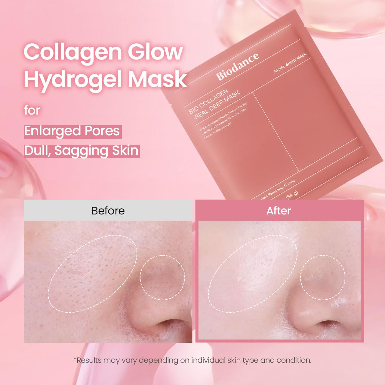 BIODANCE Bio-Collagen Real Deep Mask, Hydrating Overnight Hydrogel Face Mask, Pore Minimizing, Elasticity, Plumping, After Sun Care, Travel Essentials for Women, Korean Skin Care | 1.19oz(34g) x 4ea