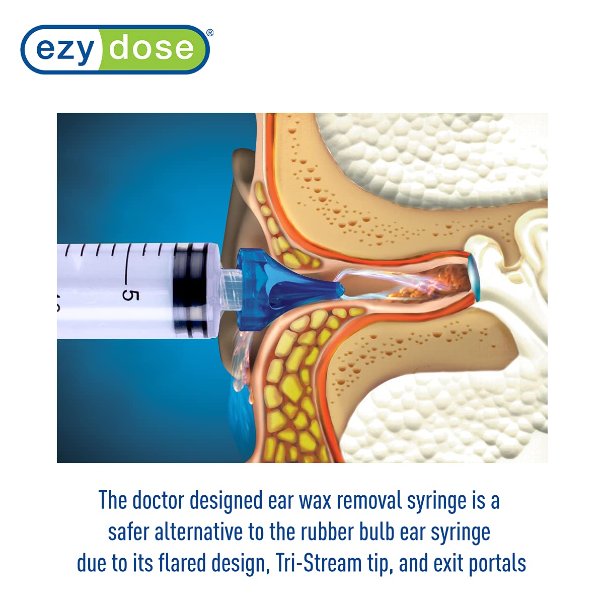 EZY DOSE Ear Wax Removal Syringe Tri-Stream Tip, Prevents Ear Infections, Safe and Effective, Easy to Use, Perfect for Kids and Adults, 20mL Capacity Clear, BPA Free