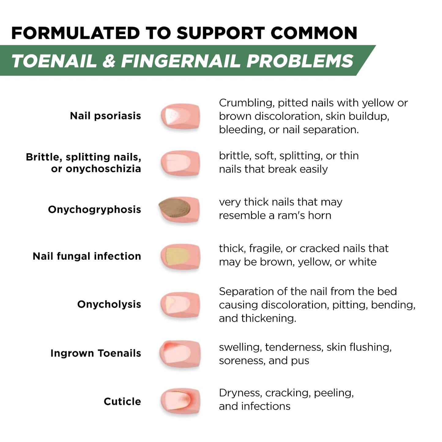 Foot Cure Toenail Fungus Treatment Extra Strength – Athletes Foot Treatment for Toenails, Restorative Nail Repair for Damaged Nails, Toenail Softener with Tea Tree Oil & Oregano Oil - Made in USA