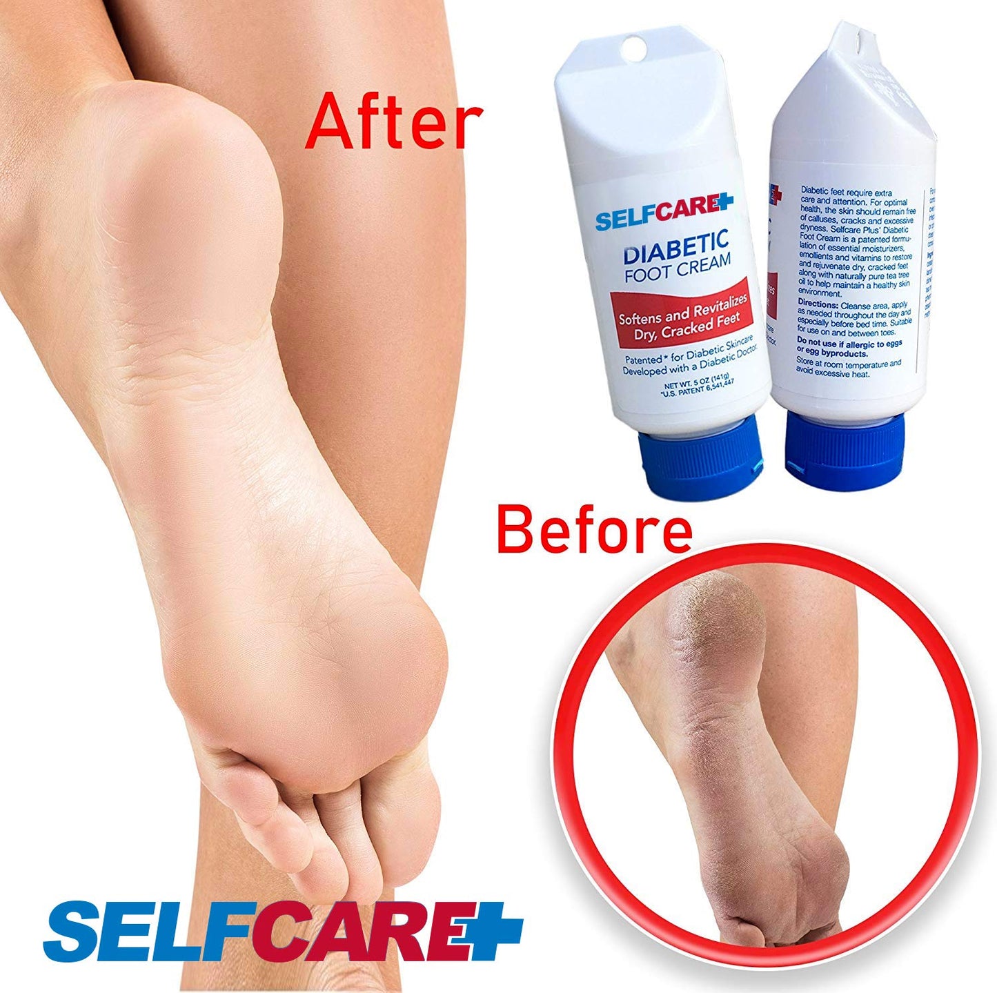 Diabetic Foot Cream For Dry Cracked Feet. Leaves Hands Legs, Feet & Body Smooth Patented Lotion, 5 oz