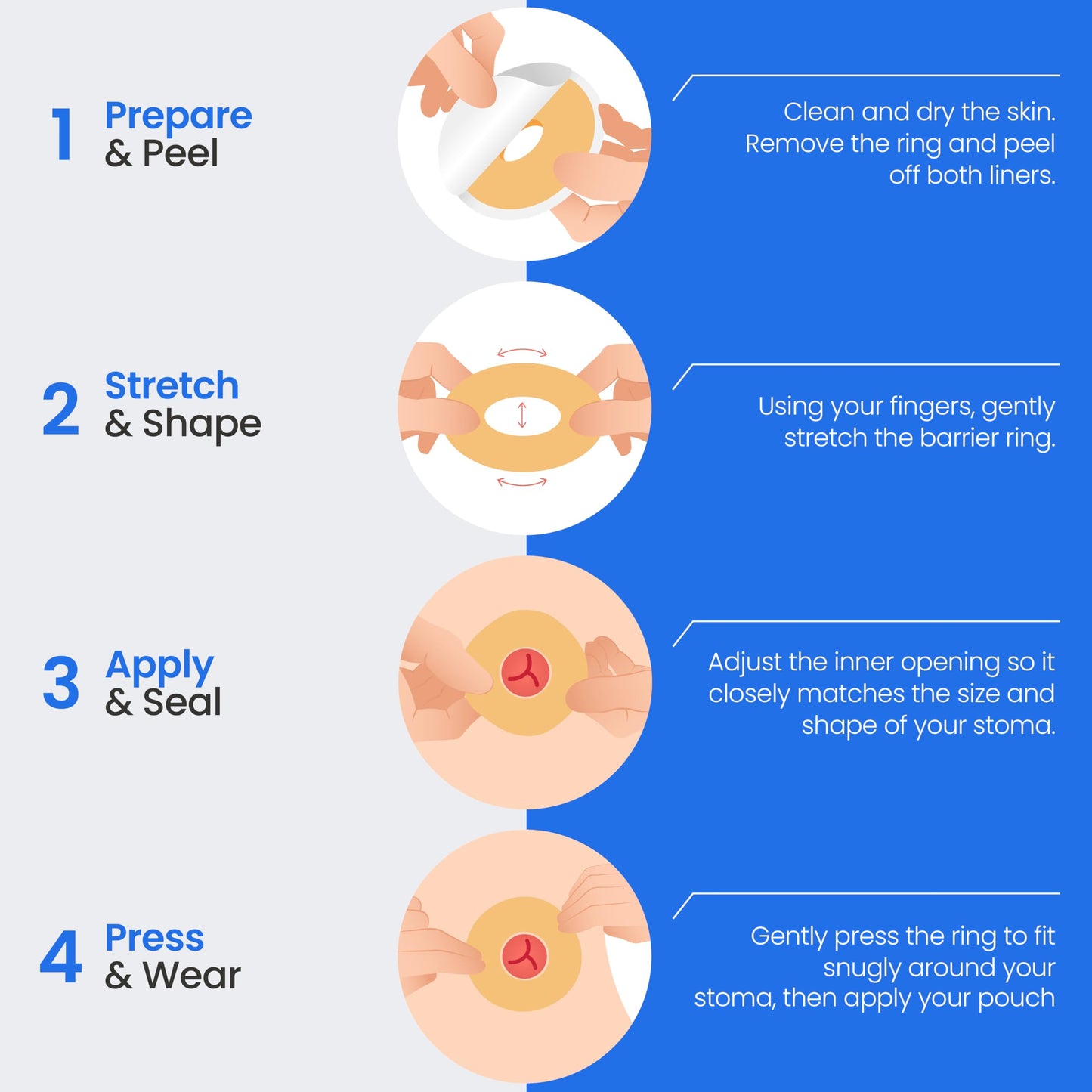 Safe n' Simple Conforming Adhesive Seals -2 Inch - Pack of 10 - Stoma Barrier Rings Barrier - Cohesive Skin Barrier - Accessories for Ostomy-Colostomy-Ileostomy- Supplies