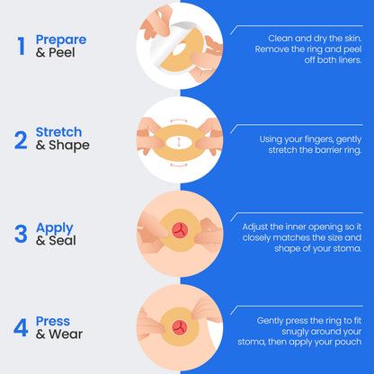 Safe n' Simple Conforming Adhesive Seals -2 Inch - Pack of 10 - Stoma Barrier Rings Barrier - Cohesive Skin Barrier - Accessories for Ostomy-Colostomy-Ileostomy- Supplies