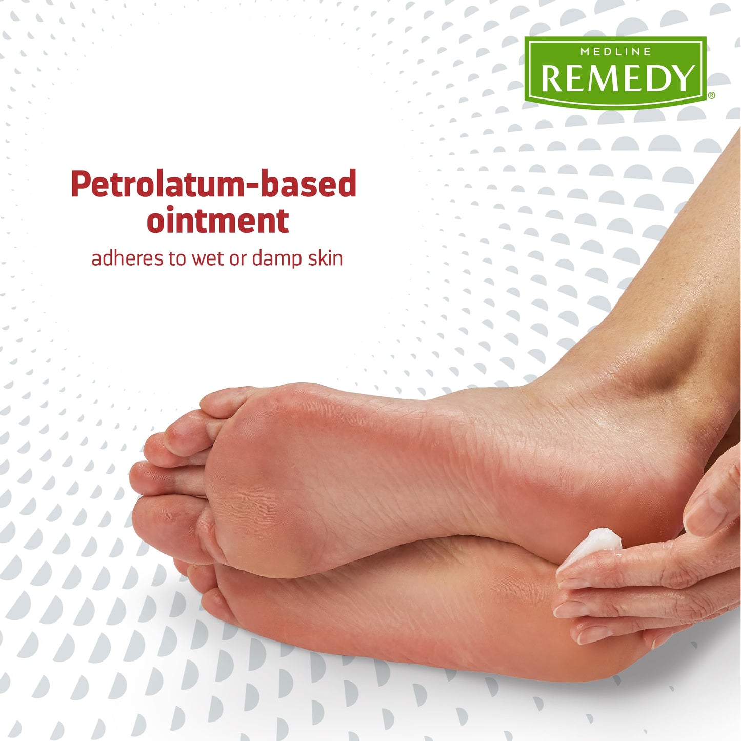 Medline Remedy Clinical Antifungal Ointment, 2.5 oz., Effective Treatment for Athlete's Foot & Ringworm, Single Tube
