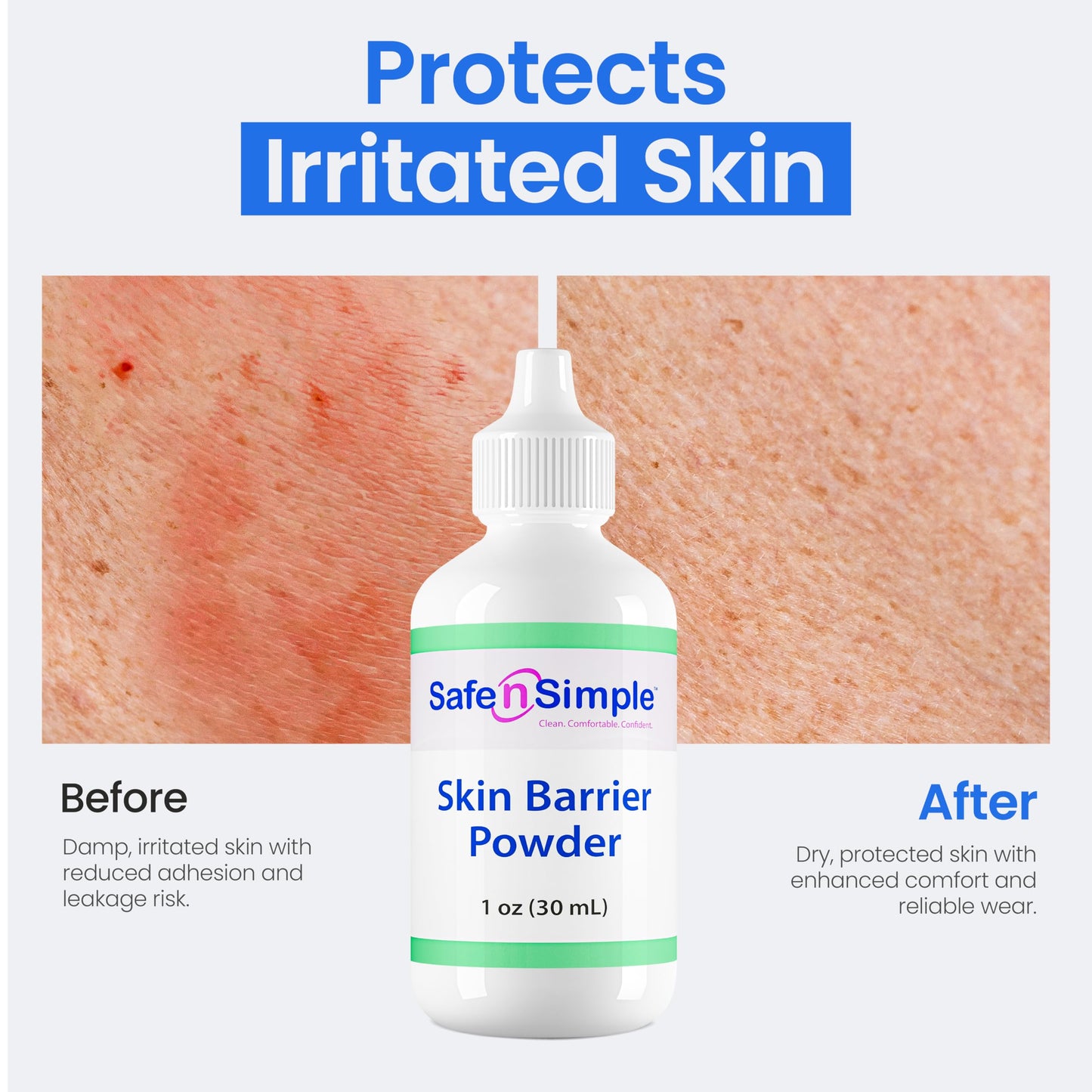 Safe n' Simple Stoma Skin Barrier Powder - 1 oz - Medicated Protective Skin Barrier Powder - Skin Barrier Protection Ostomy Powder Supplies - Stoma Adhesive Powder